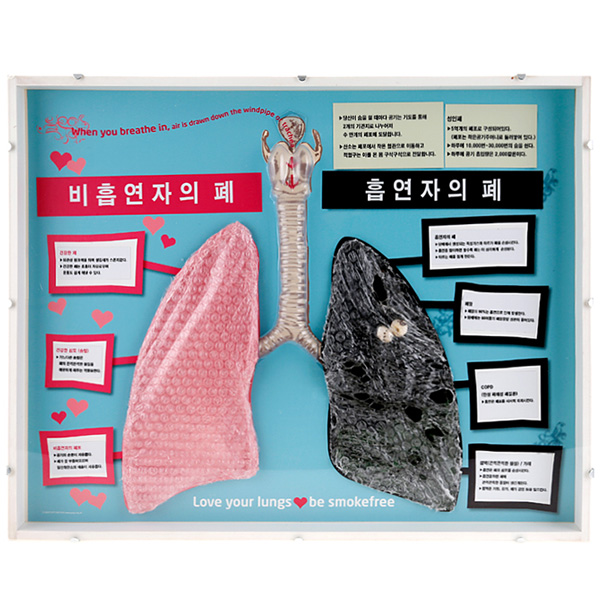 [모형.교구] 정상폐와 흡연폐