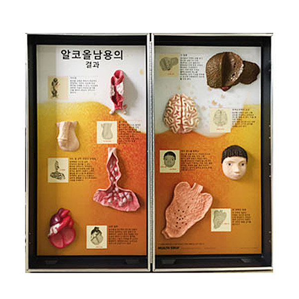 [모형.교구] 알코올 남용의 결과